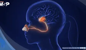 ¿Percibes olores desagradables en todo? Así actúa la parosmia