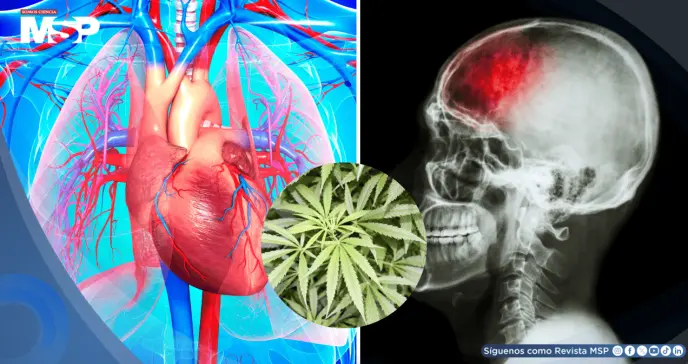 Uso habitual de marihuana se asociaría con mayor riesgo de eventos cardiovasculares y cerebrovasculares Uso habitual de marihuana se asociaría con mayor riesgo de eventos cardiovasculares y cerebrovasculares