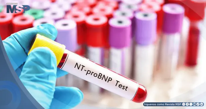 NT-proBNP podría ayudar a predecir riesgo de un nuevo evento cardiovascular tras un infarto