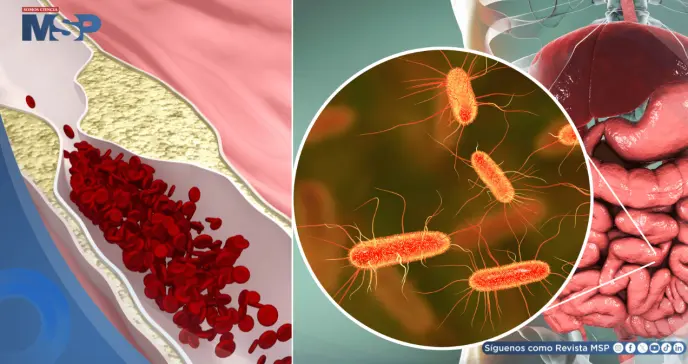 Identifican molécula producida por bacterias intestinales que podría obstruir las arterias
