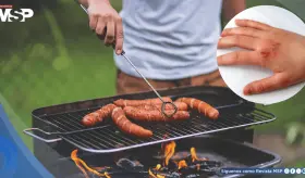 El 75% de las quemaduras en barbacoas se deben al uso incorrecto de líquidos inflamables, estudio