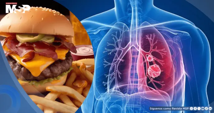 Consumo elevado de ultraprocesados se asocia con mayor riesgo de cáncer de pulmón, según estudio