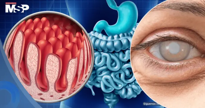 ¿Tiene intolerancia al gluten? Así podría verse afectada su salud ocular ¿Tiene intolerancia al gluten? Así podría verse afectada su salud ocular