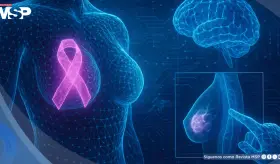 Nuevo modelo de inteligencia artificial detecta cáncer de mama con 90% de precisión