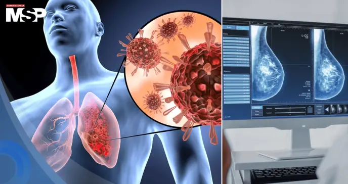 Infecciones respiratorias pueden reactivar el cáncer de mama años después del diagnóstico