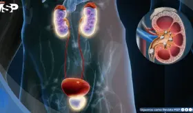 ¿Urgencia repentina de orinar? Conoce los tipos de incontinencia urinaria, síntomas y cómo tratarlos