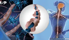 La esclerosis m&uacute;ltiple podr&iacute;a manifestarse hasta 15 a&ntilde;os antes de su diagn&oacute;stico cl&iacute;nico, seg&uacute;n estudio