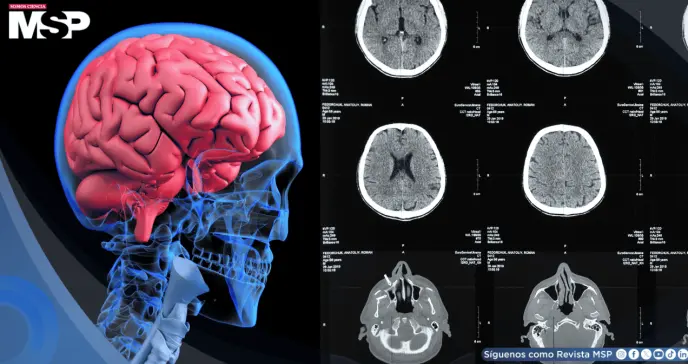Identifican biomarcador que predice respuesta a tratamientos antipsicóticos en esquizofrenia Identifican biomarcador que predice respuesta a tratamientos antipsicóticos en esquizofrenia