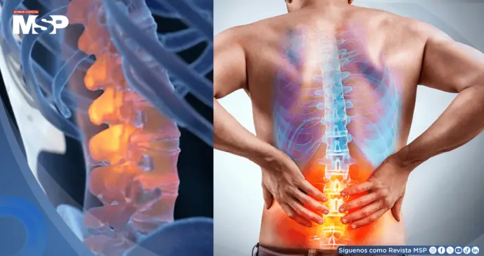 Terapia cognitiva funcional podría reducir la discapacidad por dolor lumbar crónico hasta por tres años Terapia cognitiva funcional podría reducir la discapacidad por dolor lumbar crónico hasta por tres años