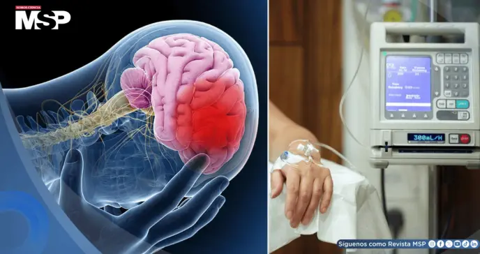 Quimioterapia se asocia a atrofia cerebral en pacientes con cáncer de mama