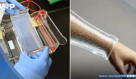 Cient&iacute;ficos crean un gel bioimpreso en 3D que promete regenerar piel sin cicatrices