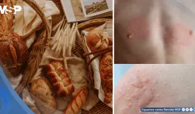 Nueva gu&iacute;a sobre la alergia al pan: causas, s&iacute;ntomas, diagn&oacute;stico y manejo