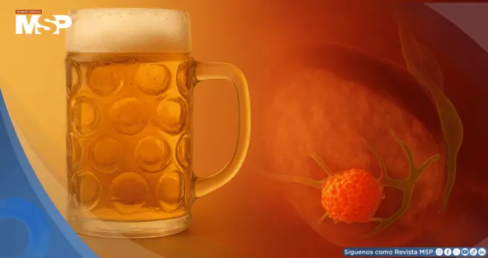 Consumo diario de alcohol eleva hasta en un 15% el riesgo de cáncer de páncreas, según estudio Consumo diario de alcohol eleva hasta en un 15% el riesgo de cáncer de páncreas, según estudio