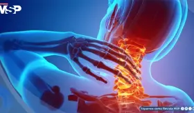 ¿Es peligroso crujirse el cuello? Así podría verse afectada la columna cervical