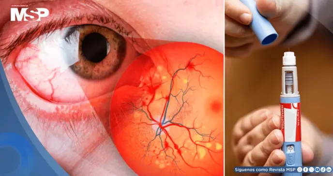 Medicamentos GLP-1 para adelgazar no aumentarían el riesgo de problemas oculares graves: Estudio