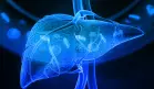 Mini-examen clínico: Evalúe sus conocimientos sobre cáncer de hígado