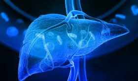 Mini-examen clínico: Evalúe sus conocimientos sobre cáncer de hígado