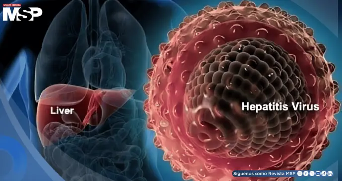 ¿Fatiga constante, dolor abdominal o piel amarillenta? Podrían ser síntomas de hepatitis autoinmune