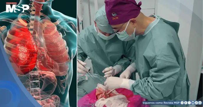 Logran el primer trasplante de pulmón de cerdo modificado genéticamente a un humano 