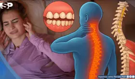 &iquest;Aprietas los dientes sin darte cuenta? El bruxismo afectar&iacute;a tu cuello, espalda, abdomen y postura