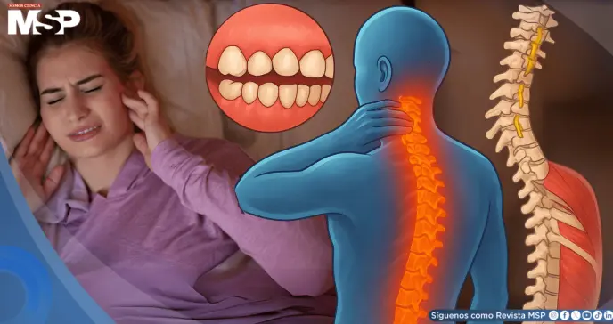 ¿Aprietas los dientes sin darte cuenta? El bruxismo afectaría tu cuello, espalda, abdomen y postura ¿Aprietas los dientes sin darte cuenta? El bruxismo afectaría tu cuello, espalda, abdomen y postura