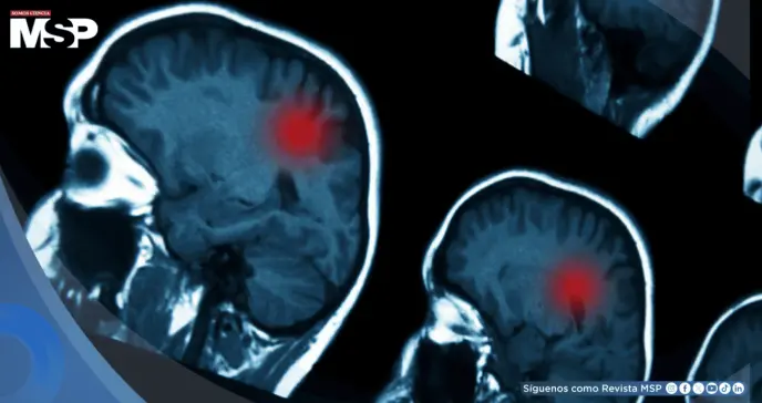 Traumatismos craneoencefálicos moderados y graves aumentan el riesgo de tumores cerebrales malignos