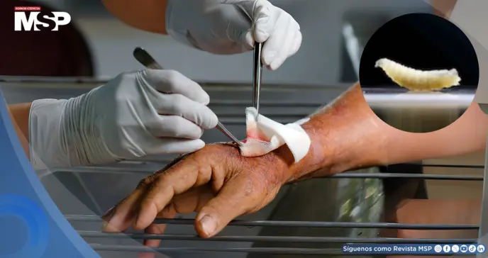 Detectan en EE. UU. el primer caso humano del gusano ´come carne´: Una infestación poco común en personas