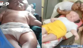 Madre mantiene viva a su hija con hidrocefalia y s&iacute;ndrome de rub&eacute;ola cong&eacute;nita: Le daban 3 meses de vida