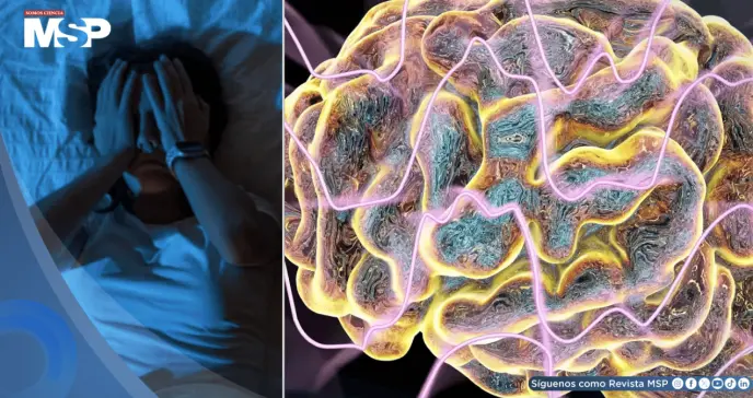 ¿Escucha estallidos o disparos al dormir? Podría ser el síndrome de cabeza explosiva