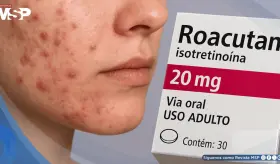 &iquest;Roacut&aacute;n para el acn&eacute; severo? Esto es lo que debes saber de automedicarse con Isotretino&iacute;na