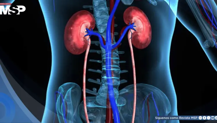 Reportan aumento de 48% de mortalidad por enfermedad renal hipertensiva  en los últimos 25 años Reportan aumento de 48% de mortalidad por enfermedad renal hipertensiva  en los últimos 25 años