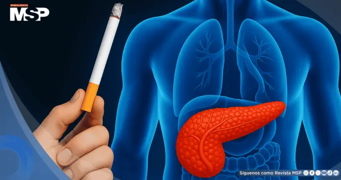 Toxinas del cigarrillo podrían acelerar el cáncer de páncreas, según estudio Toxinas del cigarrillo podrían acelerar el cáncer de páncreas, según estudio