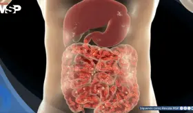 ¿Emborracharse sin beber alcohol? Todo lo que debes saber sobre el Síndrome de la autofermentación