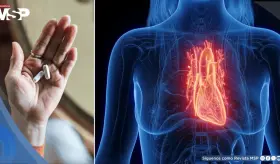Betabloqueantes tras un infarto podr&iacute;an no beneficiar a todos y aumentan el riesgo en mujeres: Estudio