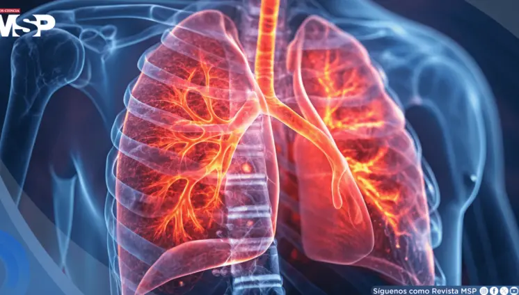 La gripe debilitaría la microbiota pulmonar y abriría la puerta a neumonías e infecciones graves
