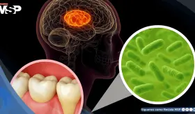 Descubren que esta bacteria com&uacute;n en la boca podr&iacute;a relacionarse con la enfermedad de p&aacute;rkinson