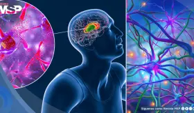 Hito m&eacute;dico: Logran ralentizar en 75% la progresi&oacute;n de la enfermedad de Huntington