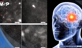 Detectan por primera vez los olig&oacute;meros de alfa-sinucle&iacute;na, prote&iacute;nas que marcan el inicio del p&aacute;rkinson