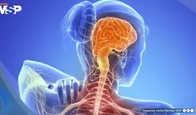 Cient&iacute;ficos descubren que la Esclerosis Lateral Amiotr&oacute;fica tendr&iacute;a un componente autoinmune