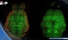 Logran revertir el alzh&eacute;imer en roedores mediante una terapia con nanopart&iacute;culas bioactivas