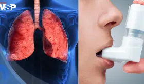 Inhaladores para el asma y la EPOC emiten m&aacute;s de 2 millones de toneladas de CO2 al a&ntilde;o: Estudio 