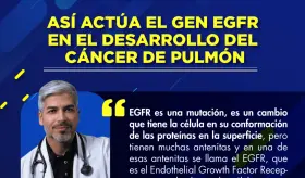 As&iacute; act&uacute;a el gen EGFR en el desarrollo del c&aacute;ncer de pulm&oacute;n