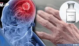 Descubren que este qu&iacute;mico industrial com&uacute;n podr&iacute;a aumentar el riesgo de padecer p&aacute;rkinson 