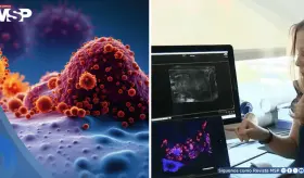 Desarrollan vacuna que lograría prevenir el melanoma, cáncer de páncreas y el de mama triple negativo