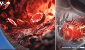 Investigadores descubren que esta prote&iacute;na podr&iacute;a provocar arritmias mortales tras un infarto 