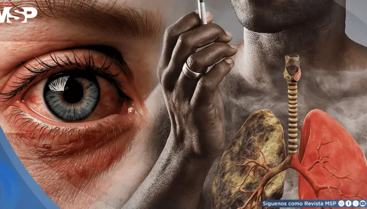 Fumar aumentaría el riesgo de ceguera: el daño sería irreversible incluso luego de dejar el cigarrillo Fumar aumentaría el riesgo de ceguera: el daño sería irreversible incluso luego de dejar el cigarrillo