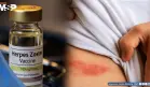 Vacuna recombinante contra el herpes zóster demuestra más del 50% de eficacia en inmunodeprimidos