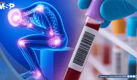 Desarrollan test sanguíneo que podría detectar síndrome de fatiga crónica con 96% de precisión