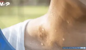 ¿Qué diferencia al sudor frío del caliente y cuándo puede ser señal de alerta médica?