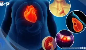 Alertan sobre el aumento de cánceres relacionados con la obesidad en jóvenes y adultos: Estudio